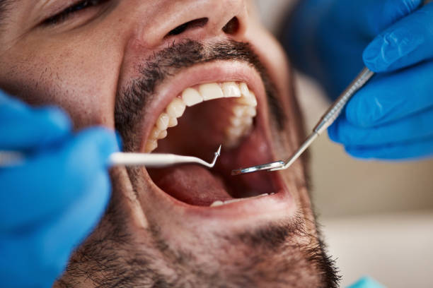 Best Emergency Tooth Extraction in Independent Hill, VA
